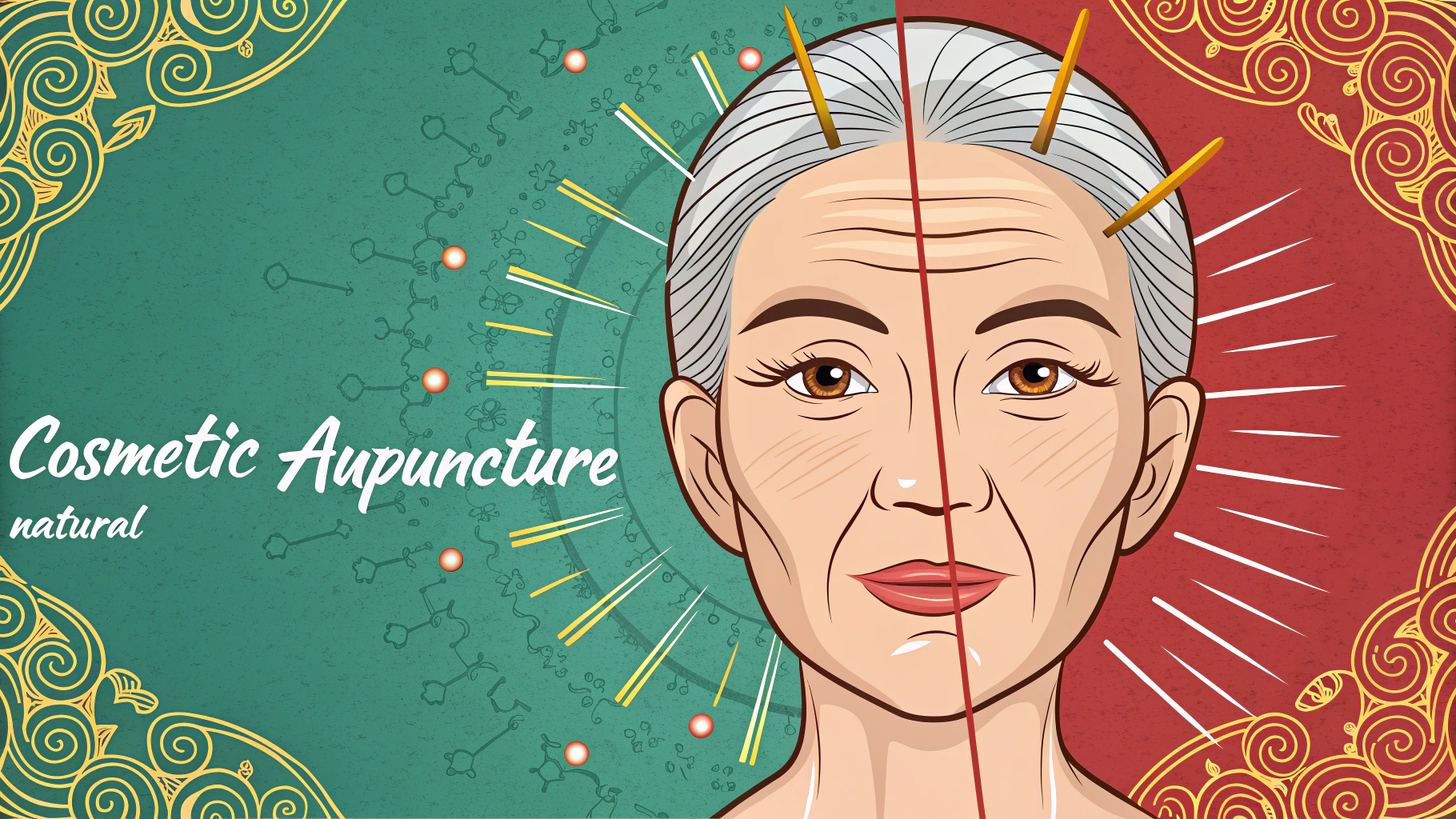 Acupuncture for Bell's Palsy